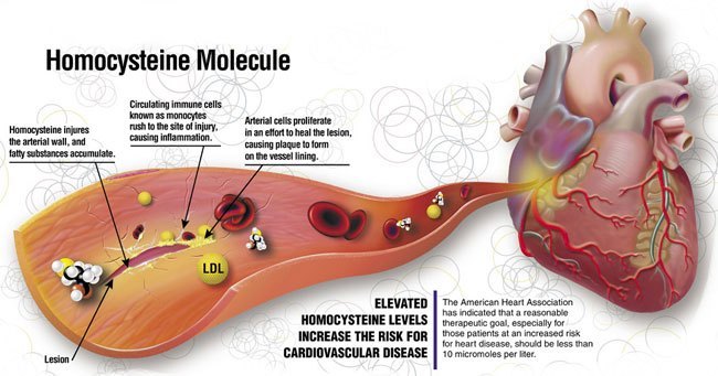 Homocysteine-levels Homocysteine levels