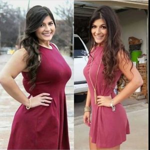 after hcg injections